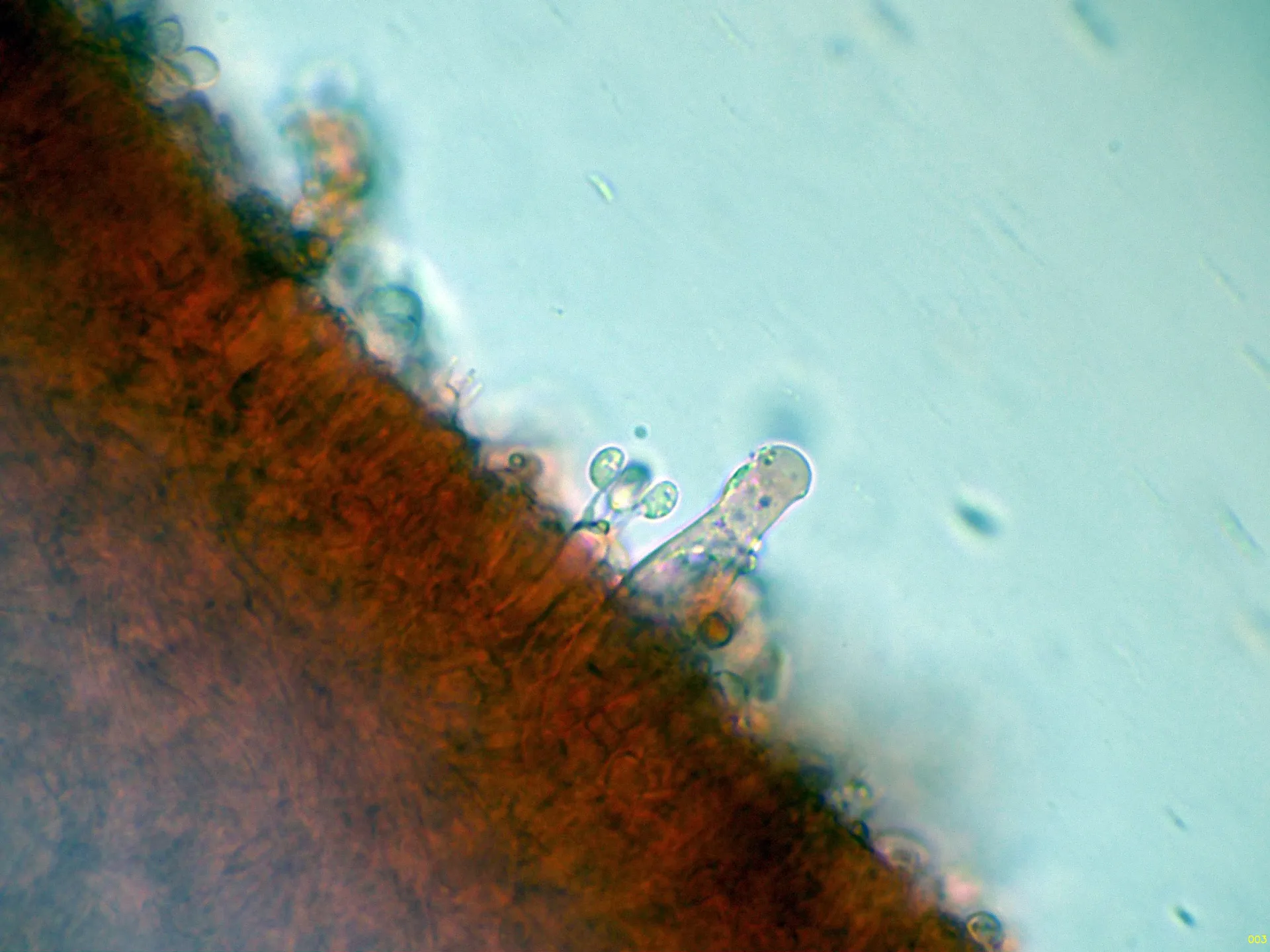 Microscopía de Strobilurus esculentus - 10 - Queilocistidio y basidio tetra-003